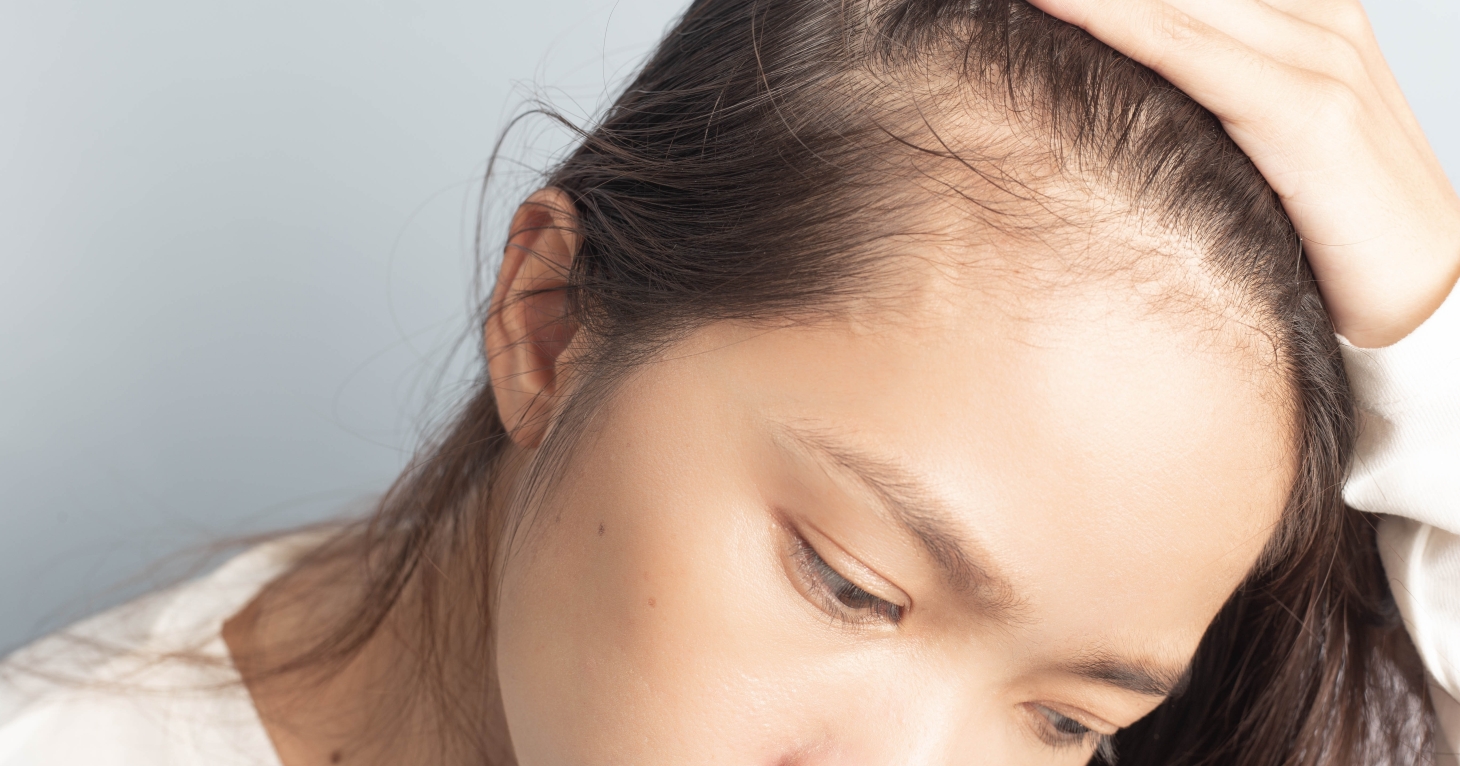 Not just for men, HeadStrong Clinic founder shares how SMP can help women experiencing hair loss